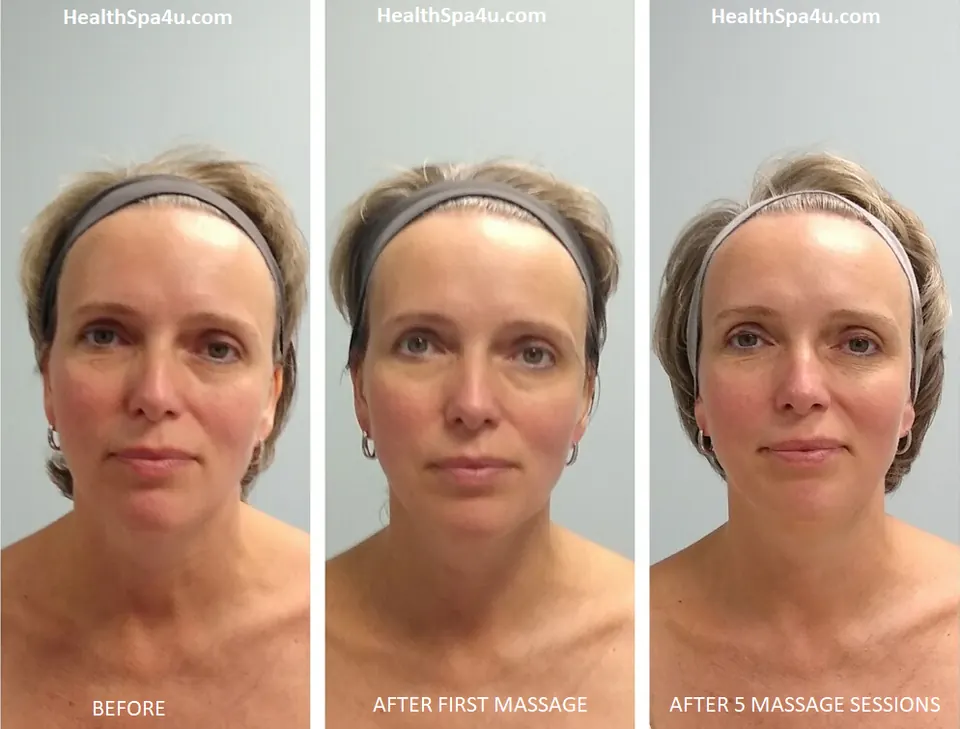 Before and After Client_6