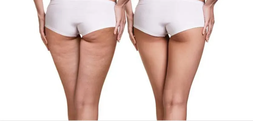 Skin Tone before and after massage
